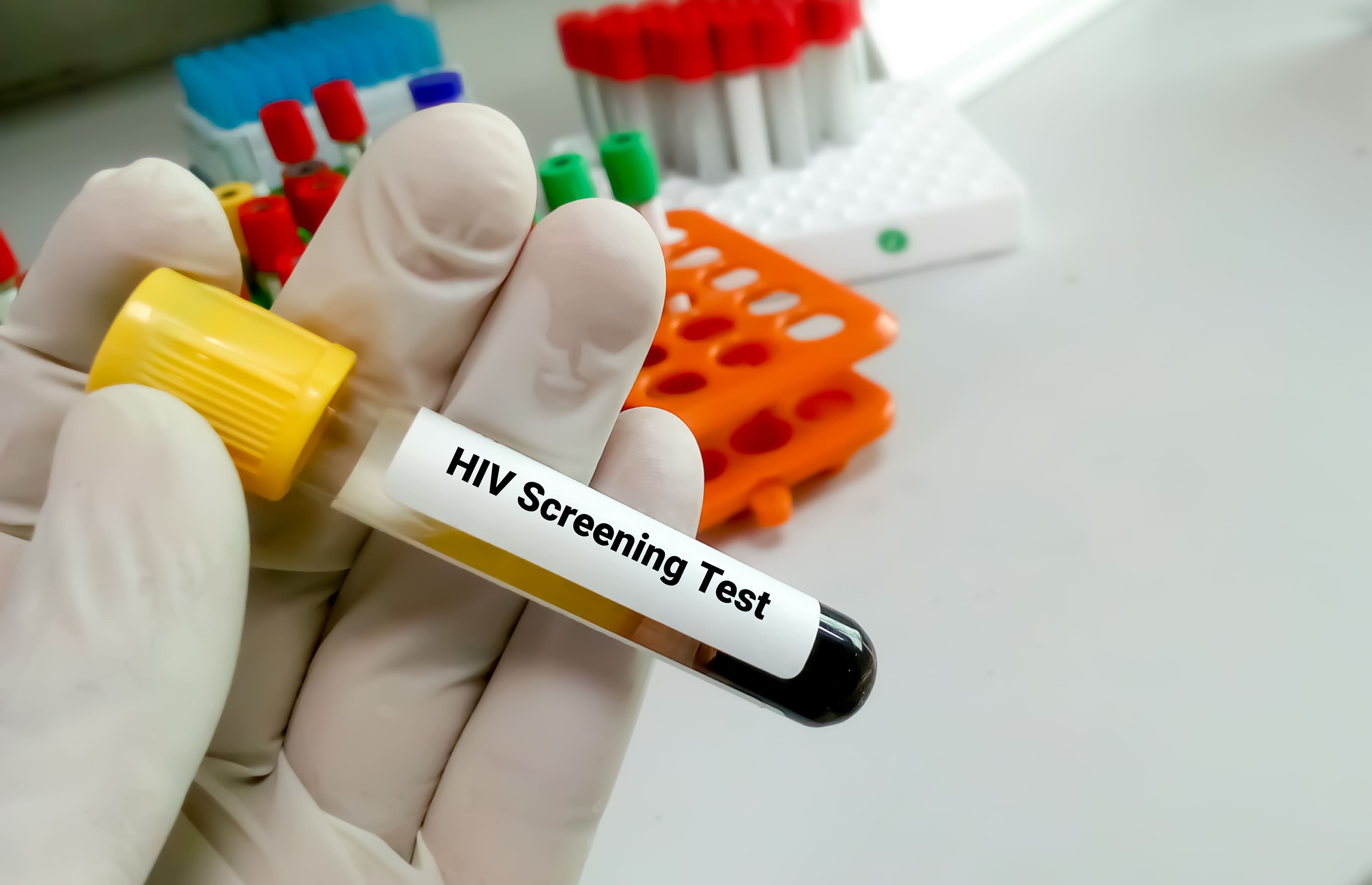 HIV Post Exposure